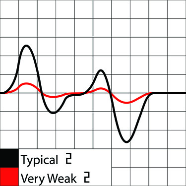 MICR weak magnetic signal