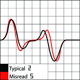 Misread (MICR substitution)